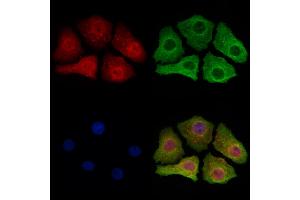 ABIN6265191 and ABIN6273164 staining Hela cells by IF/ICC. (SMOX 抗体  (Internal Region))