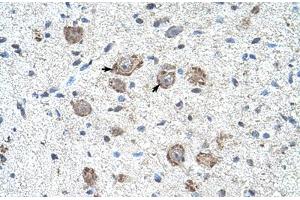 Immunohistochemical staining (Formalin-fixed paraffin-embedded sections) of human brain with KLHL25 polyclonal antibody . (KLHL25 抗体  (AA 163-212))