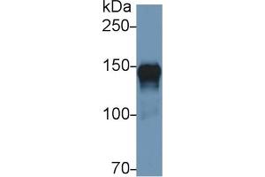 Detection of ORP150 in Human Lung lysate using Polyclonal Antibody to 150 kDa Oxygen Regulated Protein (ORP150) (150 kDa Oxygen Regulated Protein (AA 695-994) 抗体)