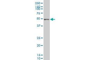 ALDH2 monoclonal antibody (M01), clone 1E5 Western Blot analysis of ALDH2 expression in MCF-7 . (ALDH2 抗体  (AA 408-517))