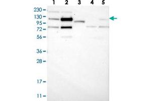 Western blot analysis of Lane 1: RT-4, Lane 2: U-251 MG, Lane 3: Human Plasma, Lane 4: Liver, Lane 5: Tonsil with ZNF592 polyclonal antibody . (ZNF592 抗体)