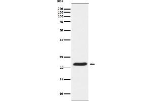 Western blot analysis of TCTP Receptor expression in HeLa cell lysate.