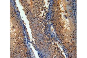 IHC-P analysis of Brain tissue, with DAB staining. (PACAP 抗体  (AA 1-175))