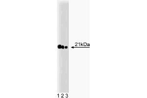 Western blot analysis of Ras on A431 lysate. (RAS 抗体  (AA 1-190))