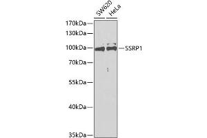 Western blot analysis of extracts of various cell lines, using SSRP1 antibody (ABIN6129536, ABIN6148492, ABIN6148494 and ABIN6217711) at 1:400 dilution. (SSRP1 抗体  (AA 1-300))