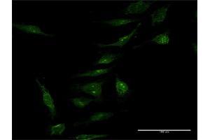 Immunofluorescence (IF) image for anti-MYC Induced Nuclear Antigen (MINA) (AA 1-465) antibody (ABIN949749)