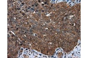 Immunohistochemical staining of paraffin-embedded colon tissue using anti-MTRF1L mouse monoclonal antibody. (MTRF1L 抗体)