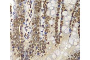 Immunohistochemistry (Paraffin-embedded Sections) (IHC (p)) image for anti-SWI/SNF Related, Matrix Associated, Actin Dependent Regulator of Chromatin, Subfamily B, Member 1 (SMARCB1) antibody (ABIN7261720)