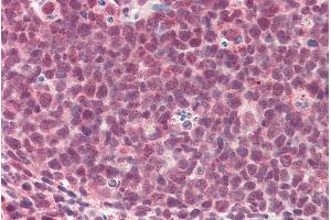 ABIN571263 (5µg/ml) staining of paraffin embedded Human Tonsil. (TMEM205 抗体  (AA 142-151))