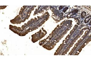 IHC analysis of delta 1 Catenin/CAS/CTNND1 using anti-delta 1 Catenin/CAS/CTNND1 antibody (ABIN7602221).