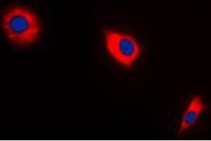 Immunofluorescent analysis of BAX staining in A549 cells. (BAX 抗体  (Center))