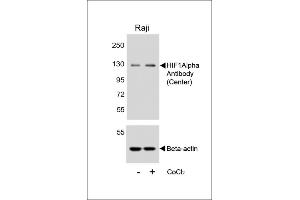Western blot analysis of lysates from Raji cell line, untreated or treated with CoCl2(0.