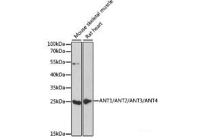 Western blot analysis of extracts of various cell lines using ANT1/ANT2/ANT3/ANT4 Polyclonal Antibody at dilution of 1:1000. (ANT1+ANT2+ANT3+ANT4 抗体)