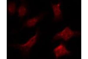 ABIN6275992 staining 293T by IF/ICC. (FZD6 抗体  (C-Term))