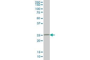 Western Blotting (WB) image for anti-Cell Death-Inducing DFFA-Like Effector B (CIDEB) (AA 3-111) antibody (ABIN599215) (CIDEB 抗体  (AA 3-111))