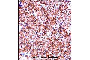 P28 Antibody (Center) (ABIN657656 and ABIN2846650) iunohistochemistry analysis in formalin fixed and paraffin embedded human pancreas tissue followed by peroxidase conjugation of the secondary antibody and DAB staining. (MMP28 抗体  (AA 195-223))