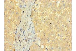 Immunohistochemistry of paraffin-embedded human liver tissue using ABIN7148140 at dilution of 1:100 (CCDC68 抗体  (AA 131-335))
