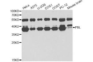Western blot analysis of extracts of various cell lines, using FBL antibody (ABIN6292110) at 1:1000 dilution.