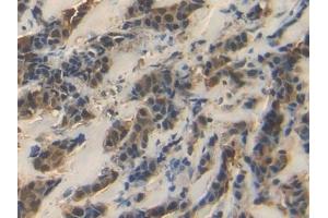 Immunohistochemistry (IHC) image for anti-Heat Shock 70kDa Protein 1A (HSPA1A) (AA 1-641) antibody (ABIN7433138)