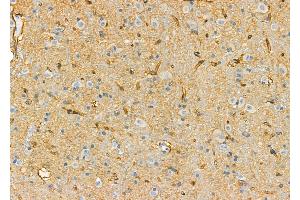 ABIN6263715 and ABIN6277123 at 1/100 staining Rat brain tissue by IHC-P.