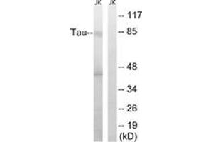 Western blot analysis of extracts from Jurkat cells, using Tau (Ab-519/202) Antibody. (tau 抗体  (AA 266-315))