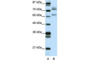 Western Blotting (WB) image for anti-GATA Zinc Finger Domain Containing 2B (GATAD2B) antibody (ABIN2460620) (GATAD2B 抗体)