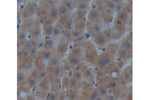 IHC-P analysis of Kidney tissue, with DAB staining. (CROT 抗体  (AA 410-612))