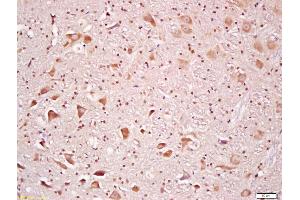 Immunohistochemistry (IHC) image for anti-Ribosomal Protein S6 Kinase, 90kDa, Polypeptide 3 (RPS6KA3) (AA 56-160) antibody (ABIN700720)