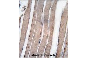 Formalin-fixed and paraffin-embedded human skeletal muscle tissue reacted with DK1 antibody (C-term) 7217b , which was peroxidase-conjugated to the secondary antibody, followed by DAB staining.