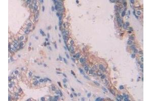 Immunohistochemistry (IHC) image for anti-Keratin 6C (KRT6C) (AA 163-482) antibody (ABIN7443299)