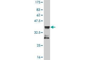 Western Blot detection against Immunogen (36. (MEF2D 抗体  (AA 256-351))