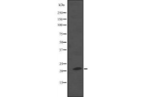 Western blot analysis of NKIRAS2 expression in A549 whole cell lysate ,The lane on the left is treated with the antigen-specific peptide. (NKIRAS2 抗体  (C-Term))