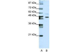 WB Suggested Anti-ZNF558 Antibody Titration:  0. (ZNF558 抗体  (N-Term))