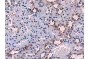 Immunohistochemistry (Paraffin-embedded Sections) (IHC (p)) image for anti-Calpain 1, Large Subunit (CAPNL1) (AA 387-694) antibody (ABIN2901959)