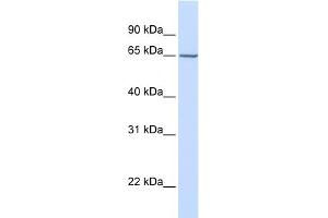 WB Suggested Anti-GALNAC4S-6ST Antibody Titration:  0. (CHST15 抗体  (Middle Region))