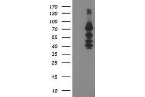 Western Blotting (WB) image for anti-Katanin P80 (WD Repeat Containing) Subunit B 1 (KATNB1) antibody (ABIN1498990) (KATNB1 抗体)