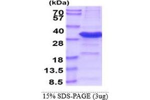 SDS-PAGE (SDS) image for Iodotyrosine Deiodinase (IYD) (AA 24-214) protein (His tag) (ABIN5853588) (IYD Protein (AA 24-214) (His tag))