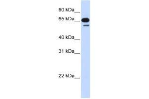 WB Suggested Anti-R3HDM2 Antibody Titration: 0. (R3HDM2 抗体  (Middle Region))