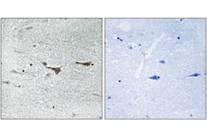 Immunohistochemistry analysis of paraffin-embedded human brain tissue, using TOB1 (Ab-164) Antibody. (Protein Tob1 (TOB1) (AA 130-179) 抗体)