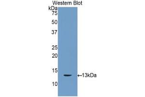 Western blot analysis of the recombinant protein. (Connexin 31 抗体  (AA 7-102))