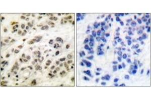 Immunohistochemistry (IHC) image for anti-Myc Proto-Oncogene protein (MYC) (AA 31-80) antibody (ABIN1532205)