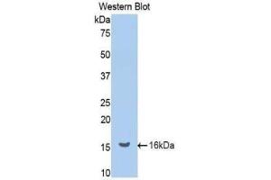 Western blot analysis of the recombinant protein. (Renin 抗体  (AA 265-386))