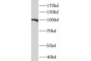 NIH/3T3 cells were subjected to SDS PAGE followed by western blotting (WB) with ABIN7114073 (MEG3 Antibody) at dilution of 1:1000 (MEG3 抗体)