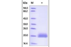 Human LAIR-2, His Tag on SDS-PAGE under reducing (R) condition. (LAIR2 Protein (AA 22-152) (His tag))