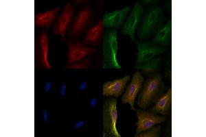 ABIN6257514 and ABIN6276058 staining  cells by IF/ICC.