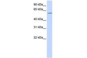 Image no. 1 for anti-Zinc Finger and BTB Domain Containing 7A (ZBTB7A) (AA 108-157) antibody (ABIN6740515) (ZBTB7A 抗体  (AA 108-157))