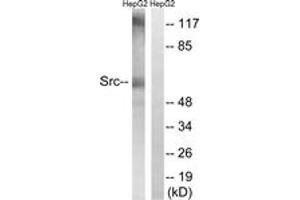 Western blot analysis of extracts from HepG2 cells, using Src (Ab-216) Antibody. (Src 抗体  (AA 181-230))
