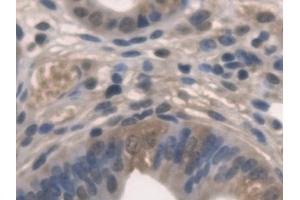 Immunohistochemistry (IHC) image for anti-Pyridoxamine 5'-Phosphate Oxidase (PNPO) (AA 1-261) antibody (ABIN7444253)