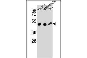 ZFP30 Antibody (N-term) (ABIN657359 and ABIN2846409) western blot analysis in ZR-75-1,MDA-M,293 cell line lysates (35 μg/lane).