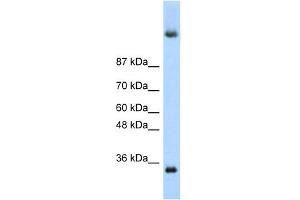 WB Suggested Anti-DAZ4 Antibody Titration:  0. (DAZ4 抗体  (N-Term))